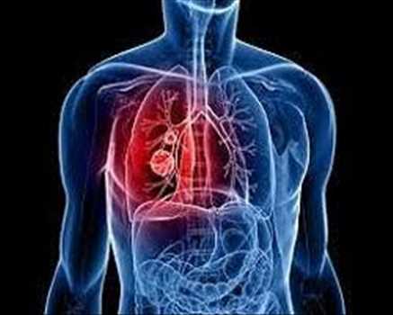 Diagnostic respiratoire marché
